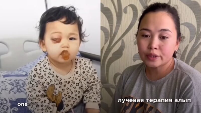 Көз рагы оорусуна чалдыккан Эркеайым жардамга муктаж