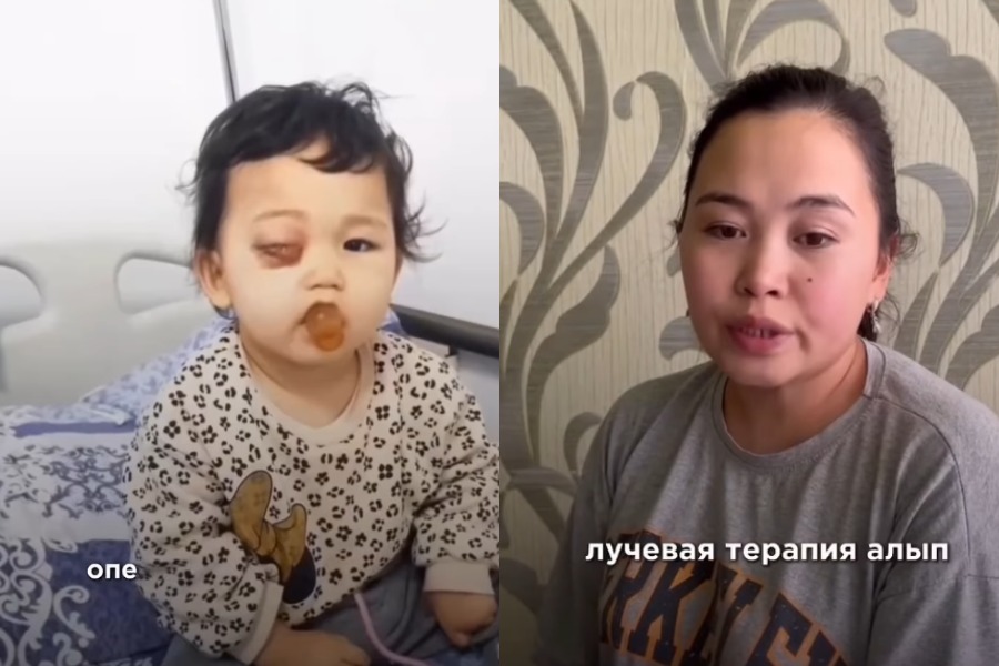 Көз рагы оорусуна чалдыккан Эркеайым жардамга муктаж