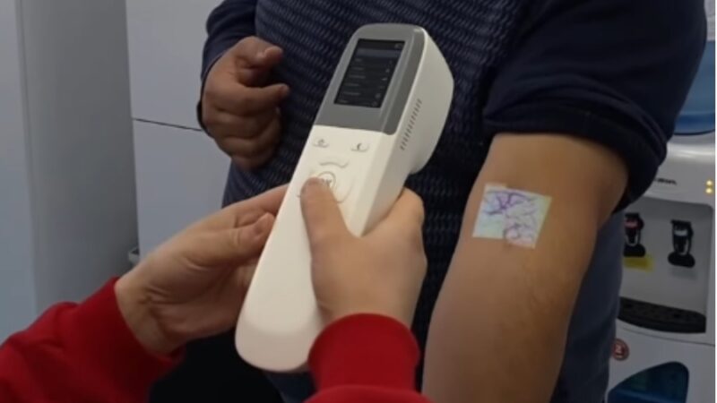 Медайымдар балдардын кан тамырын эми теринин сыртынан сканерлей алышат