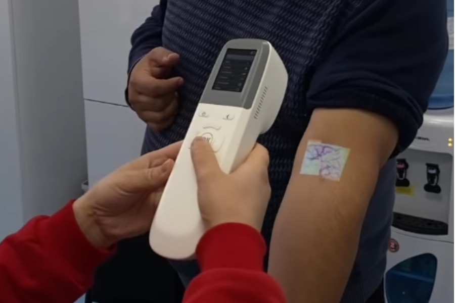 Медайымдар балдардын кан тамырын эми теринин сыртынан сканерлей алышат