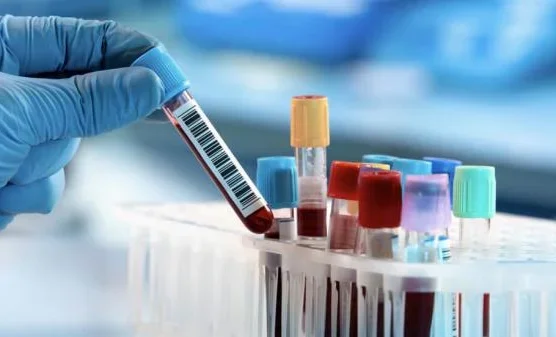 Депутат жеке клиникаларда анализдердин баасы 5 миң сомго чейин жетерин айтты