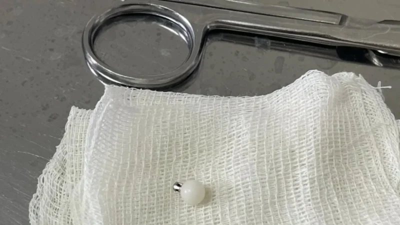 Бишкекте 1 жашар наристенин өпкөсүнөн шуру алып чыгышты