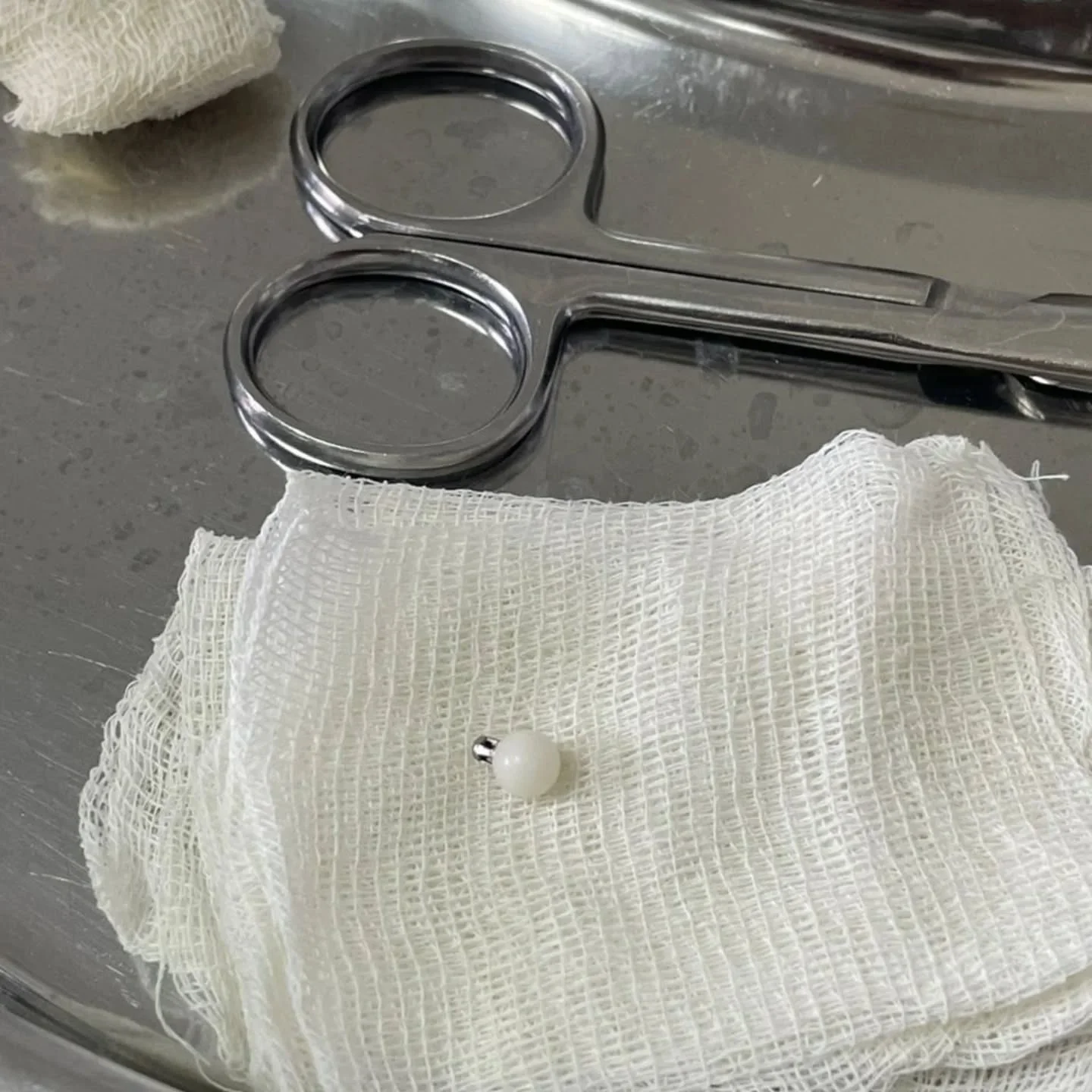 Бишкекте 1 жашар наристенин өпкөсүнөн шуру алып чыгышты