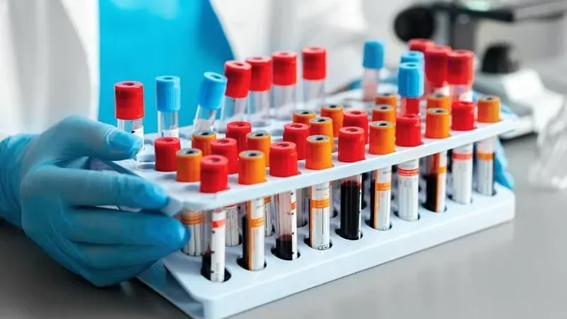 Бонецкий лабораториясында оор абалдагы бейтаптар үчүн 40% жеңилдик берилет