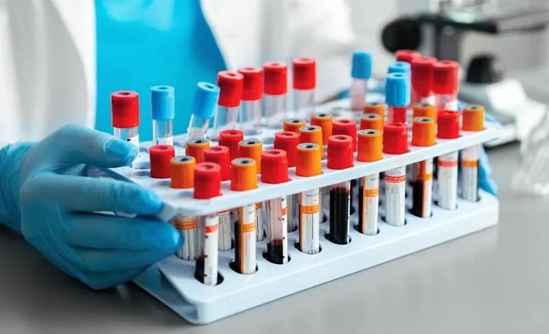 Бонецкий лабораториясында оор абалдагы бейтаптар үчүн 40% жеңилдик берилет